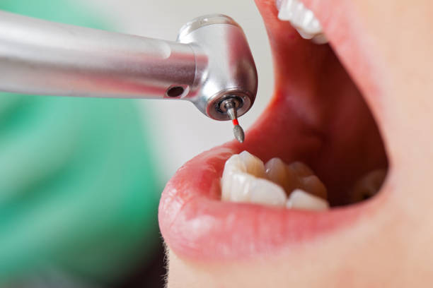 Best Knocked-Out Tooth Emergency  in Pensacola, FL